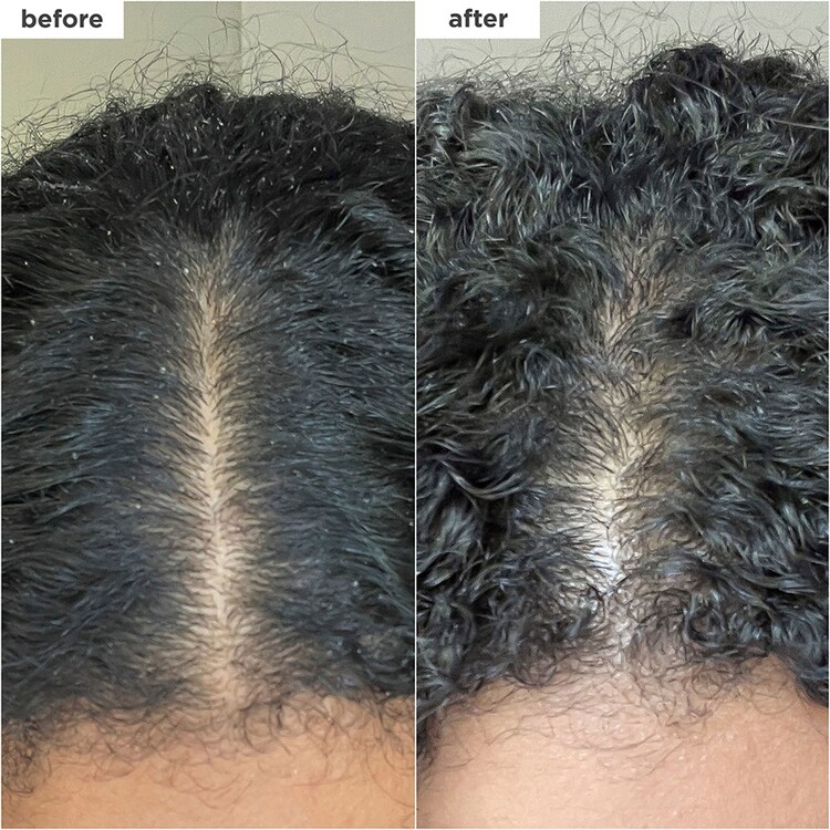 Scalp Revival Charcoal - Champú exfoliante