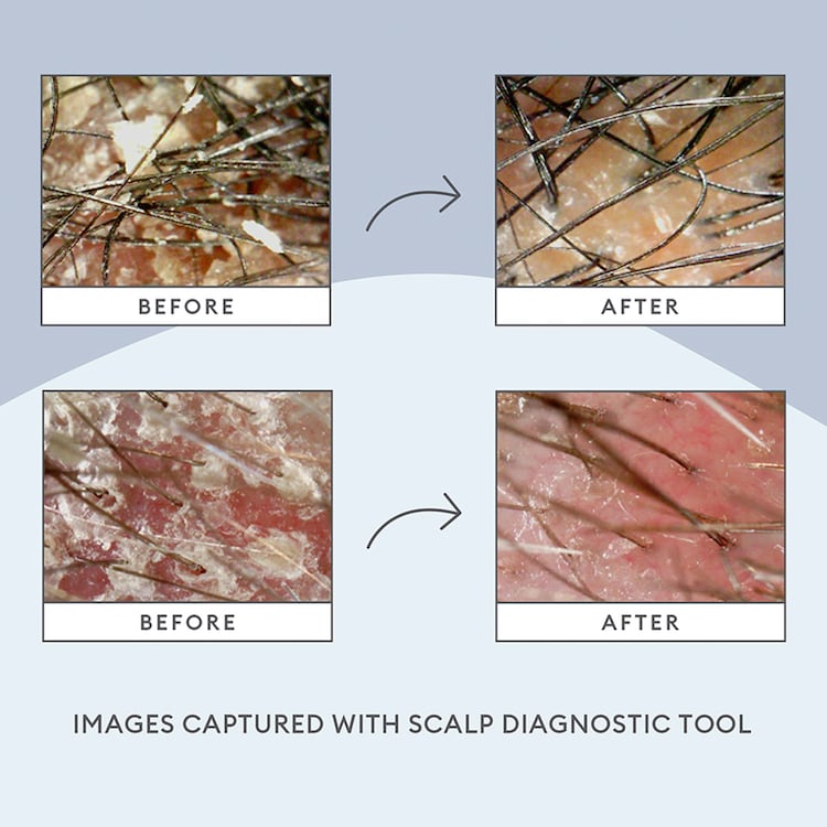 Scalp Revival Charcoal - Tratamiento para el cuero cabelludo 