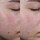 Blemish Clearing Paste- Pâte anti-imperfections
