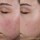 Blemish Control Moisturizer - Crema hidratante antimperfecciones