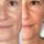 Resveratrol-Lift - Sérum Lifting Firmeza 