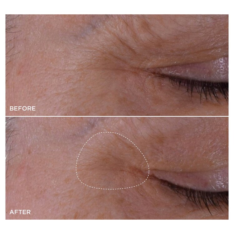 Double Serum Eye - Ser pentru ochi