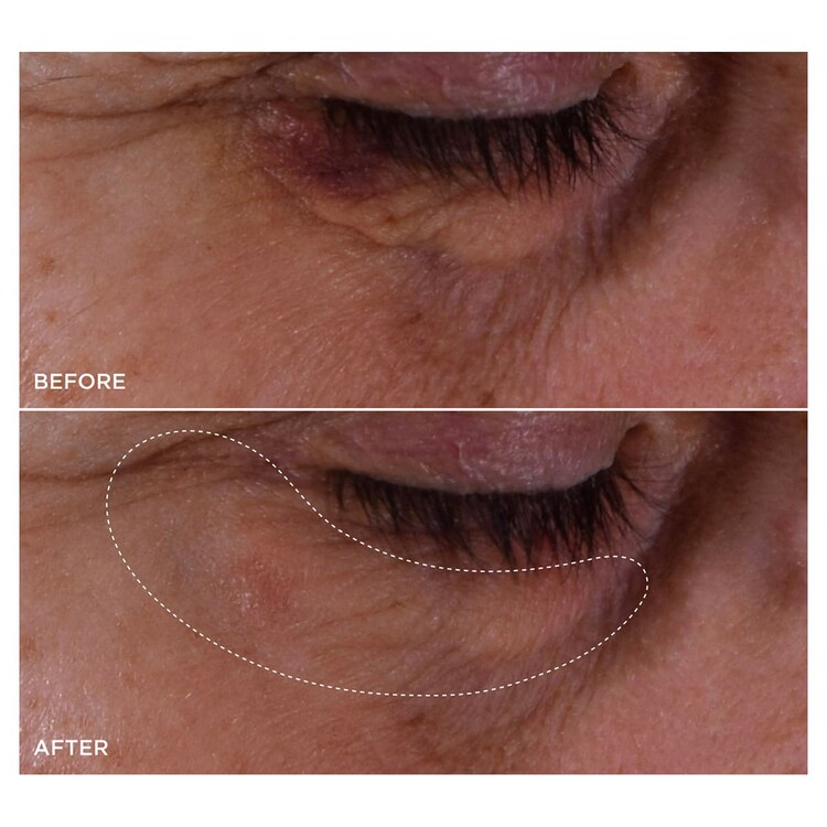 Double Serum Eye - Ser pentru ochi