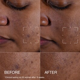 Even Better Clinical&trade; - Serum i ulja za lice
