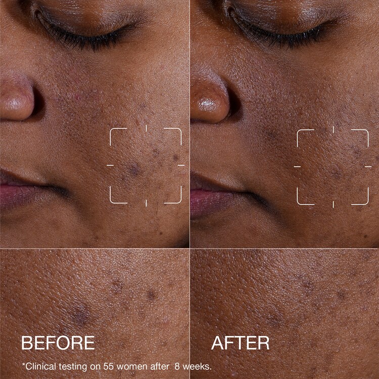 Even Better Clinical™ Dark Spot Clearing Serum - Siero Anti Macchie