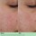 Clinique Smart Clinical Repair™ - Collagen + PDRN Cream