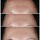 Smart Clinical Repair™ - Wrinkle Correcting Serum