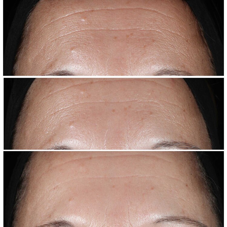Smart Clinical Repair™ - Wrinkle Correcting Serum
