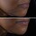 Smart Clinical Repair Lifting Face + Neck Cream - Micro-Lift Moisturizer 