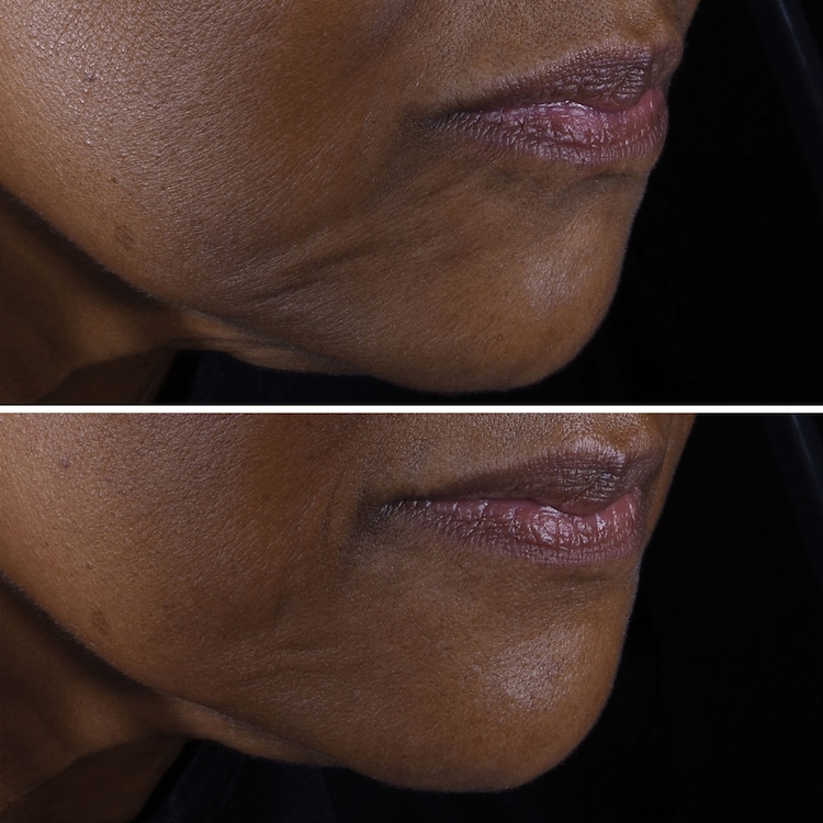 Smart Clinical Repair Lifting Face + Neck Cream - Micro-Lift Moisturizer 