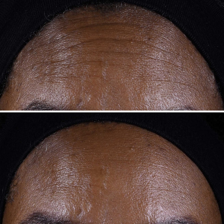 Smart Clinical Repair Lifting Face + Neck Cream - Micro-Lift Moisturizer 