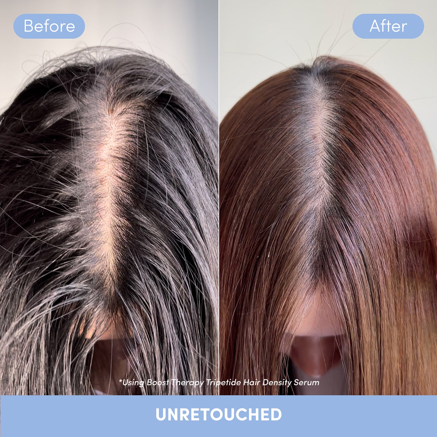 Boost Therapy - Tripeptide Hair Density Serum
