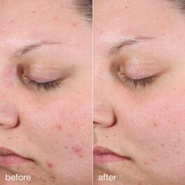 Age Bright Clearing Serum - Protiv nepravilnosti