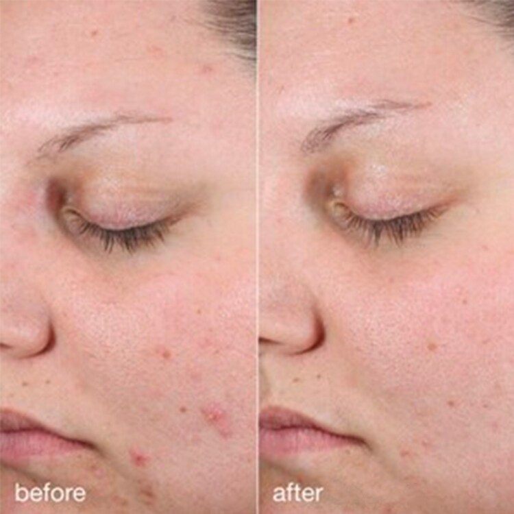 Age Bright Clearing Serum - Sérum proti nedokonalostem