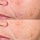 Retinol Clearing Oil