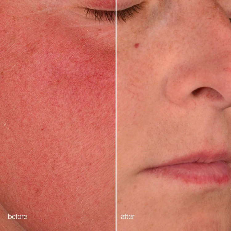 Retinol Clearing Oil