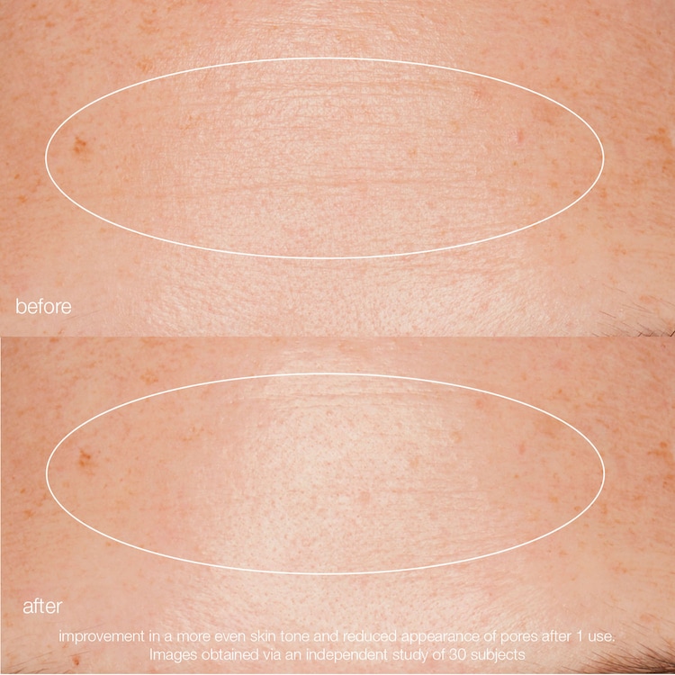 Daily Liquid Peelfoliant - Exfoliant pentru ten
