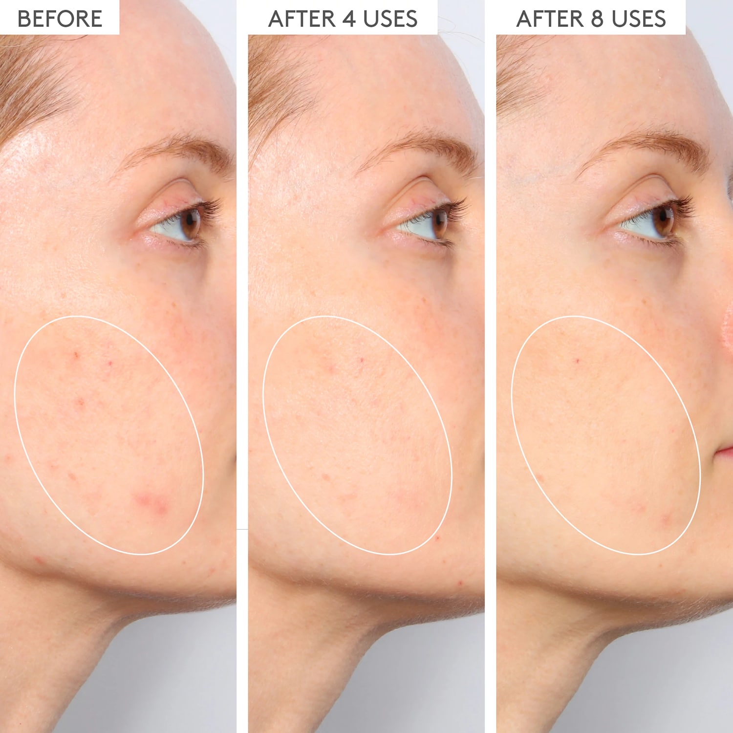 T.L.C. Sukari Babyfacial™ Reformulation