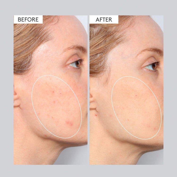 T.L.C. Sukari Babyfacial™ - Dybderensende Ansigtsmaske