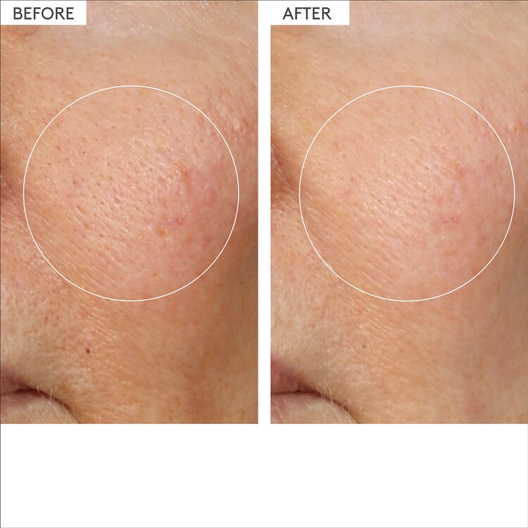 T.L.C. Framboos™ Glycolic Night Serum - Siero Notte Con Acido Glicolico