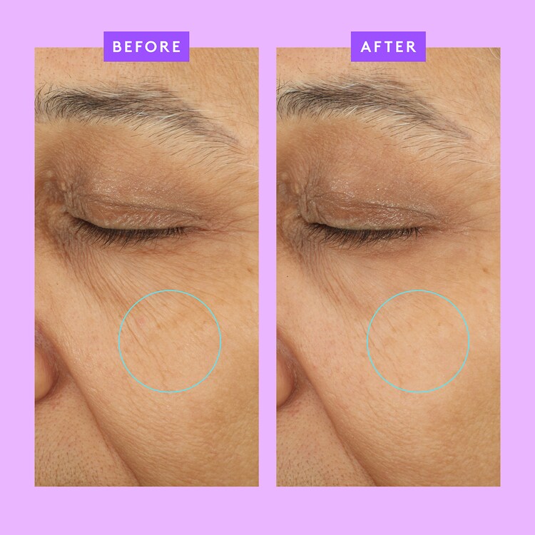 Ceramighty™ AF Eye Balm - Anti-aging eye cream