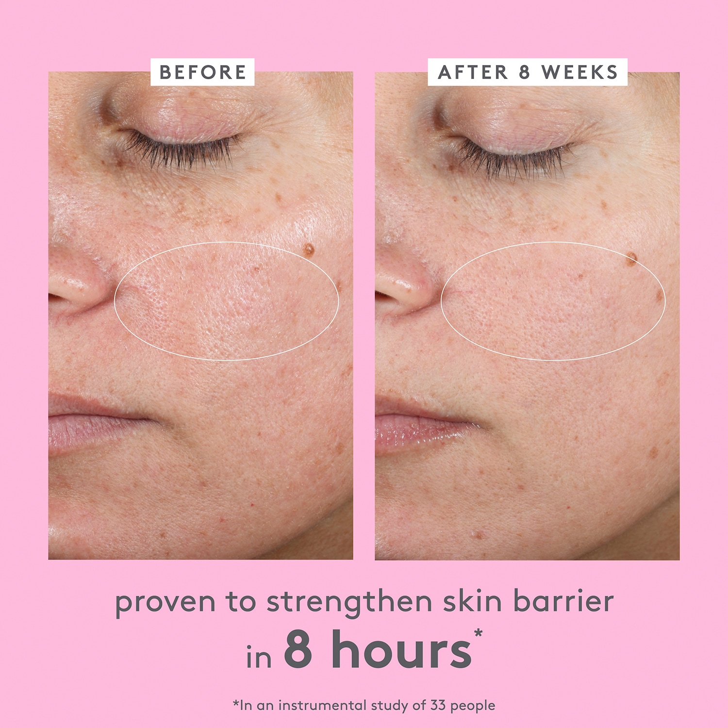 Bora Barrier Repair Cream