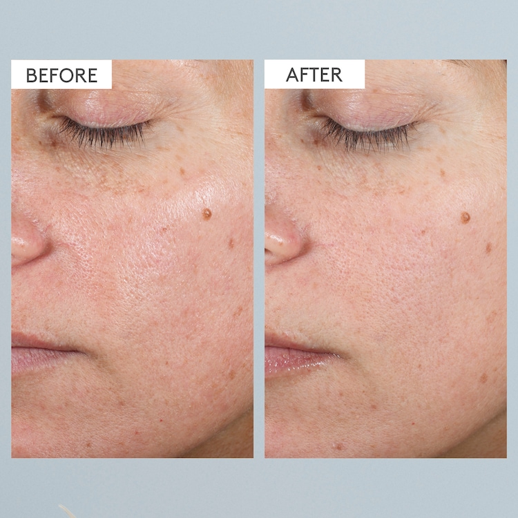 Bora Barrier Crème Réparatrice - Crème visage riche en lipides & céramides