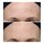 Alpha Beta® - Peeling Diario Ultrasuave