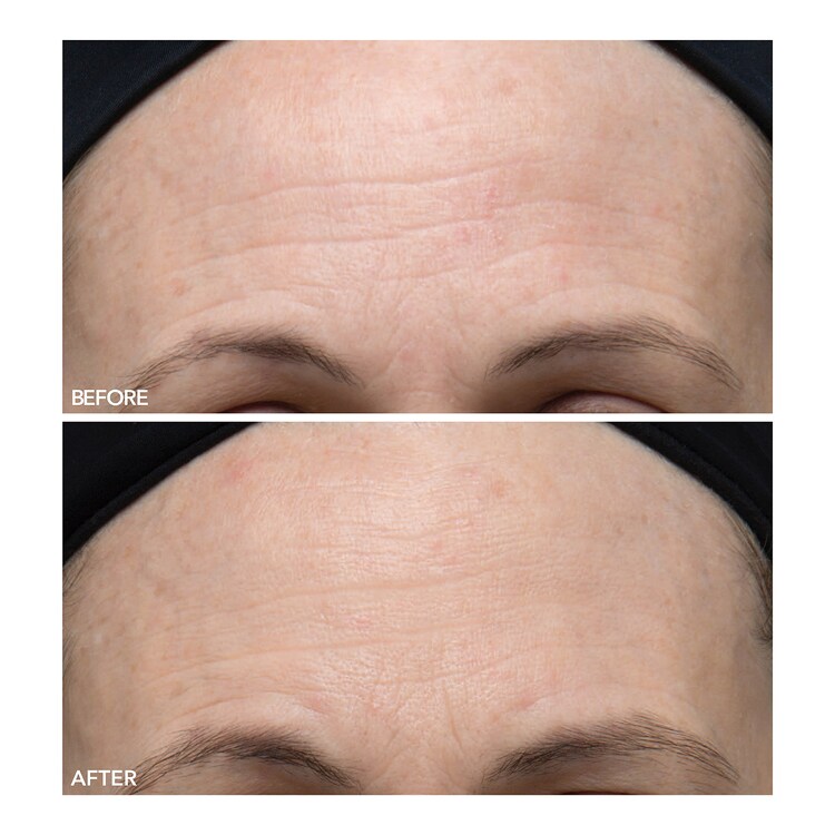 Alpha Beta® - Peeling Diario Ultrasuave