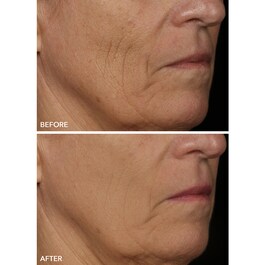Spectralite FaceWare Pro