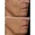 FaceWare Pro - Mascarilla Facial LED
