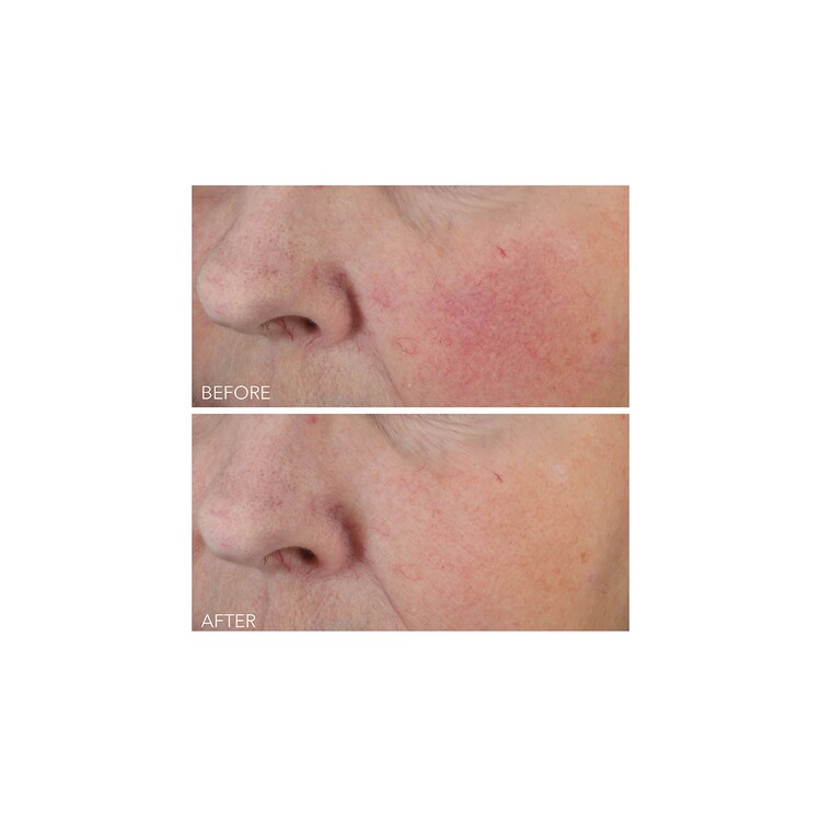 Vitamin C + Lactic - Soin Hydratant Intense Fermeté Lift