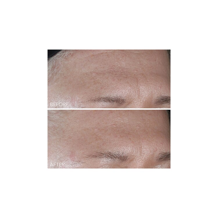 Vitamin C + Lactic - Soin Hydratant Intense Fermeté Lift