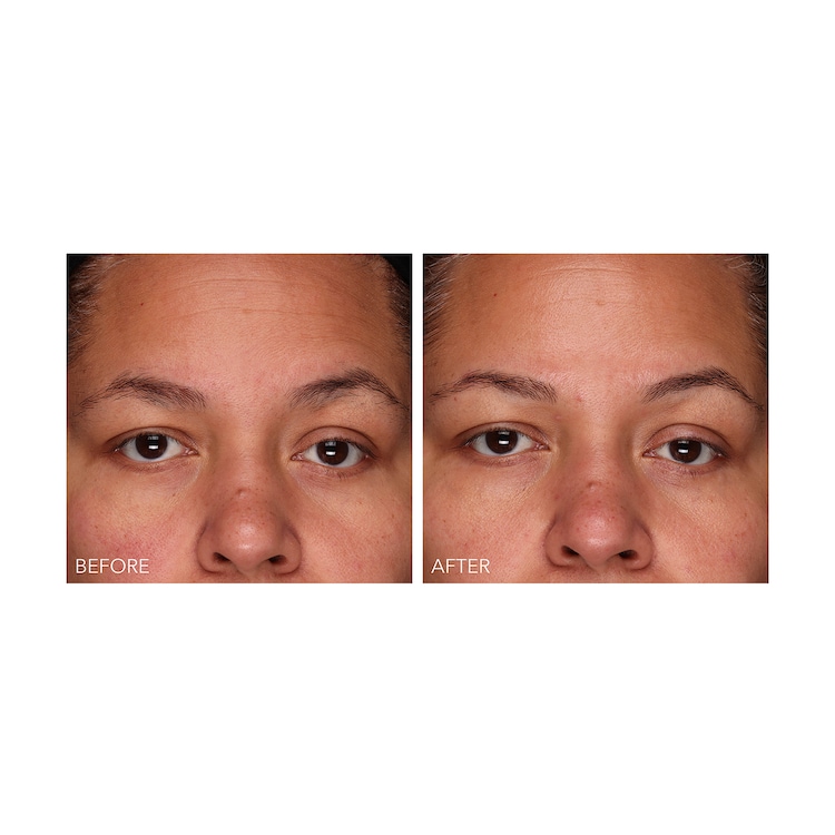 DermInfusions - Gel zur schnellen Regeneration