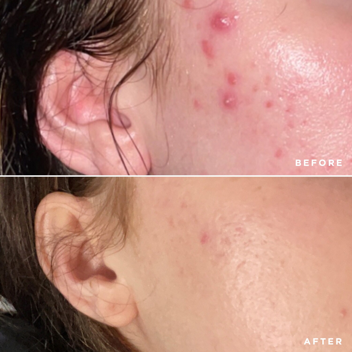Flawless Cleanser