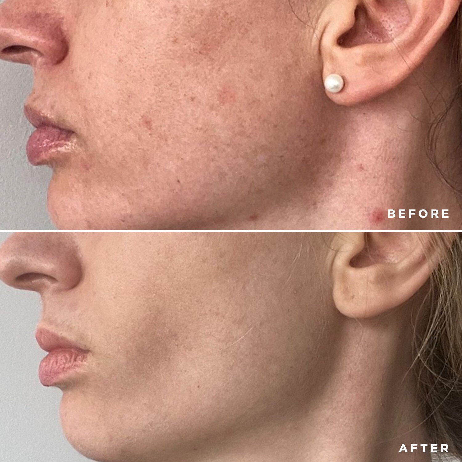 Flawless Vitamin C NAD+ Serum