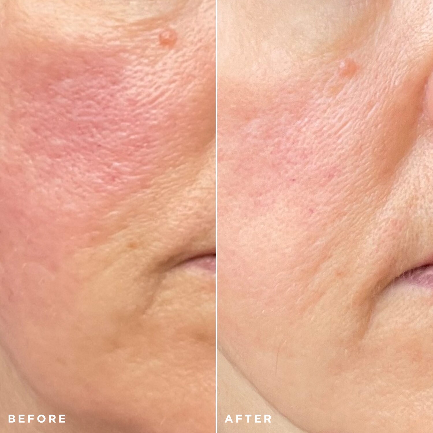 Flawless Brightly Serum