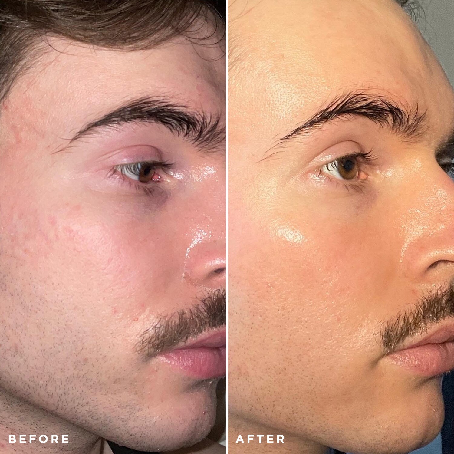 Flawless Nightly Pro Serum