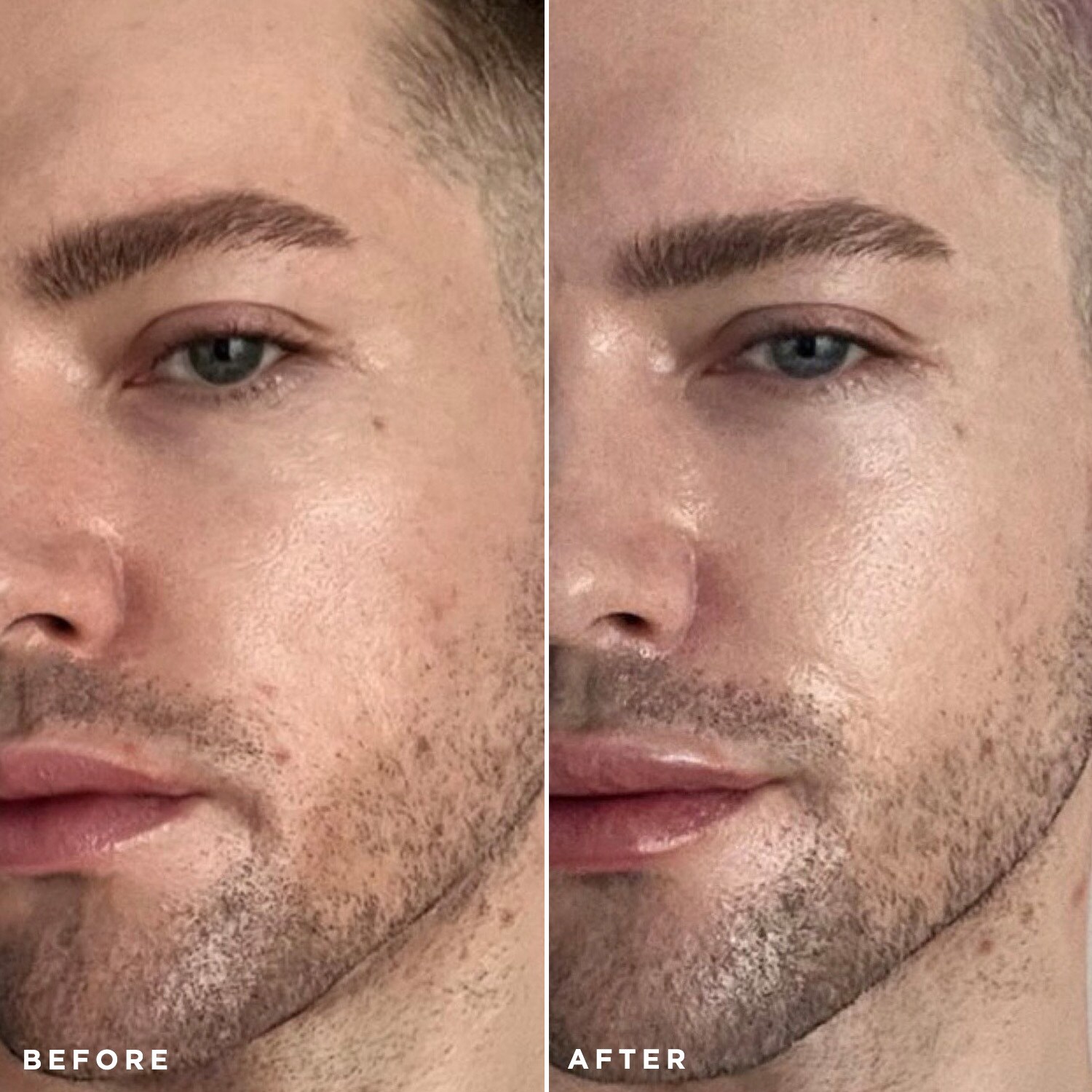 Flawless Moisturiser Intense
