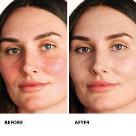 Centella Red Serum - Koncentrat za trenutno olak&scaron;anje