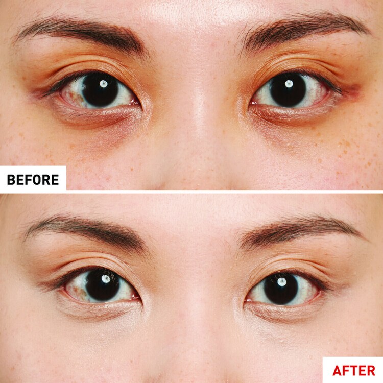 Super BB Concealer – Antiolheira alta cobertura com Ginseng
