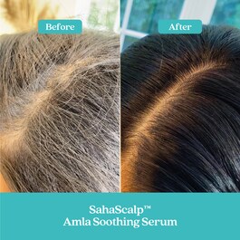 SahaScalp&trade; - Amla umirujući serum