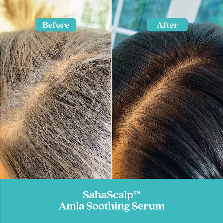 SahaScalp™  à l'Amla - Sérum Apaziguante
