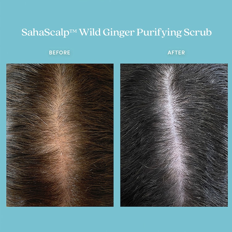 SahaScalp™ - Wild Ginger Purifying Scrub