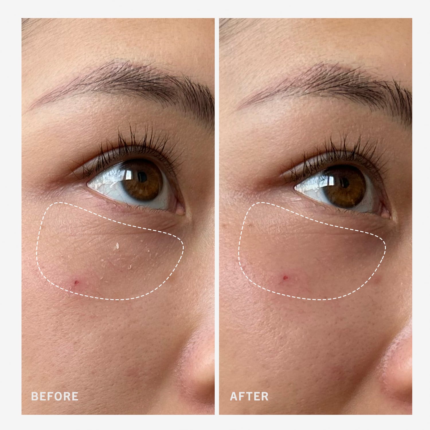 Ultra Repair Rescue Barrier Balm