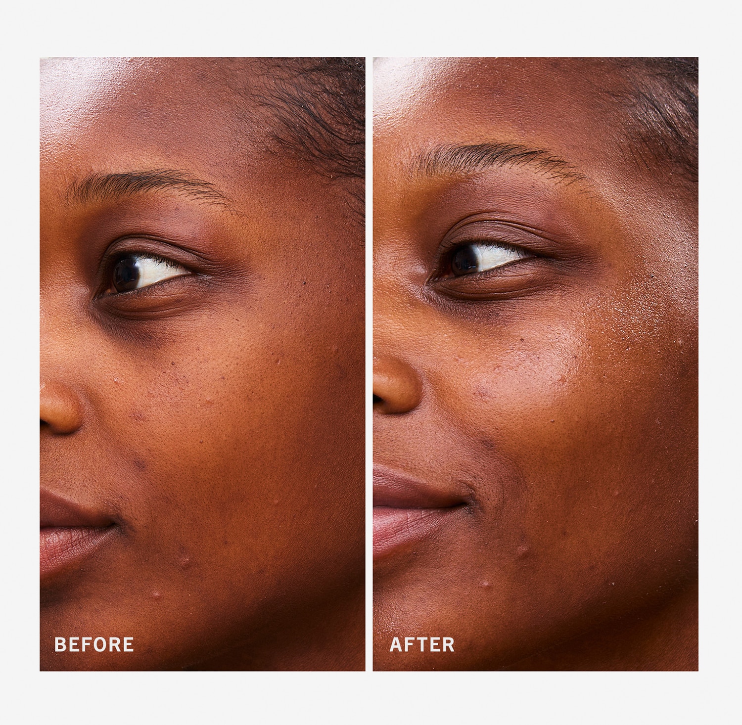 Hydrating Dewy Gel Cream - Face Moisturiser with Hyaluronic Acid +Ceramides
