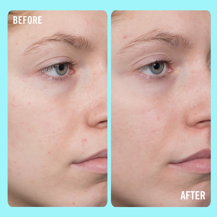 10% Vitamin C Brightening Serum - Ser iluminator cu 10% vitamina C