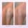 Ingrown Hair Pads - Kompostierbare Pads gegen eingewachsene Haare x60