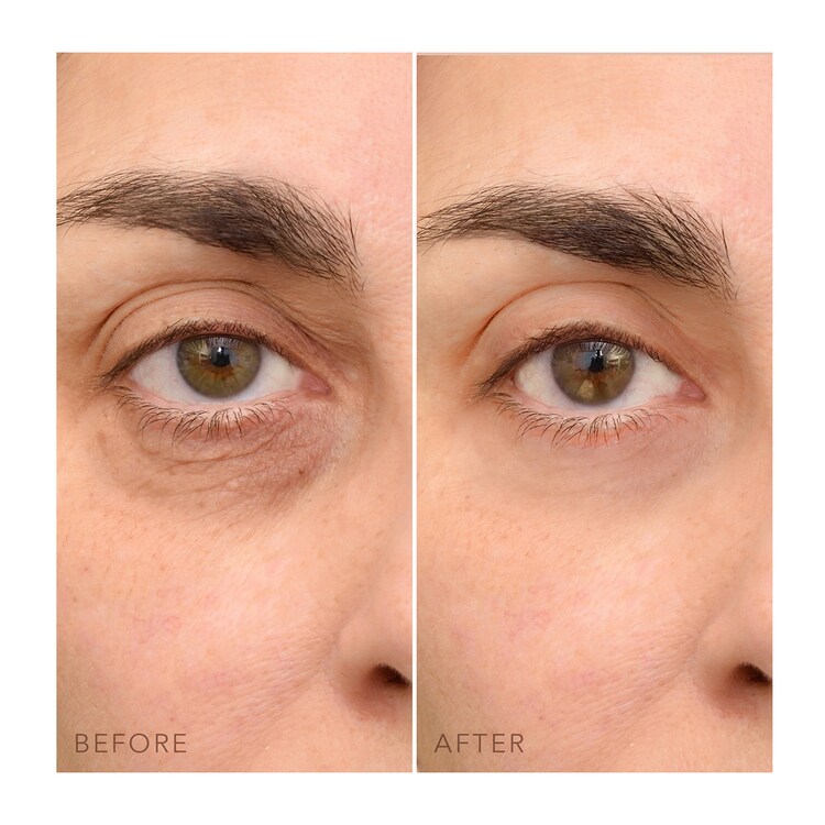 IRIS™ C-Concentrated Brightening Eye Cream - Skoncentrowany krem pod oczy 