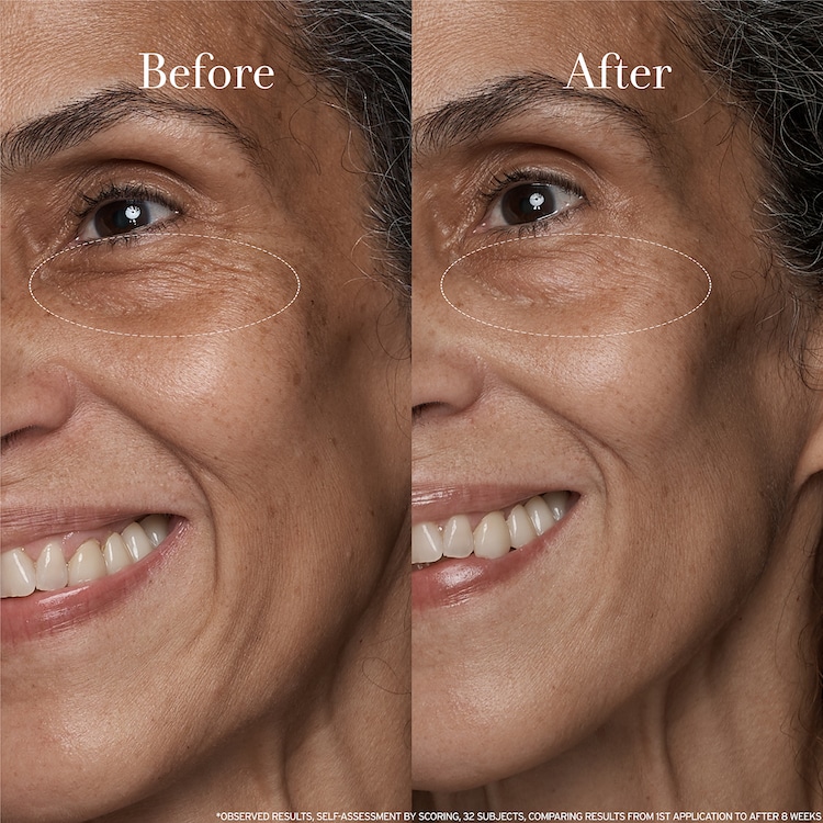 Black Tea Age Renewal Eye Concentrate – Αντιγηραντική κρέμα ματιών